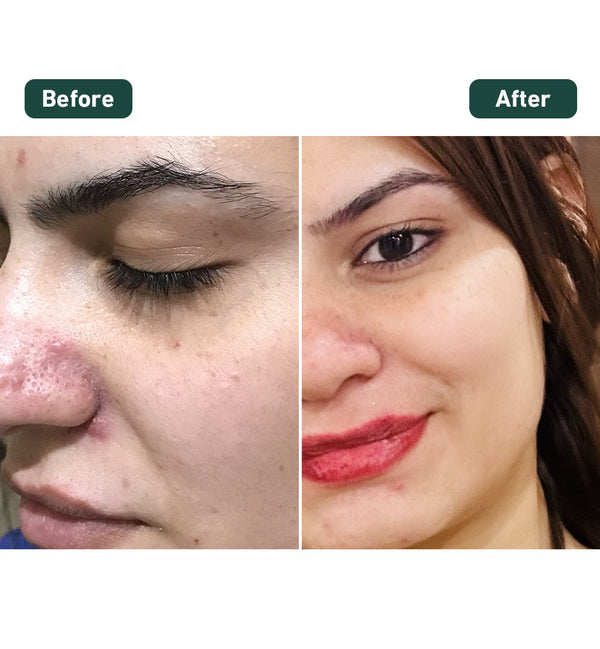 India’s First Mexico-Sourced Cactus-Infused Skin Tightening Gel - Shop authentic Indian Beauty by Evermore