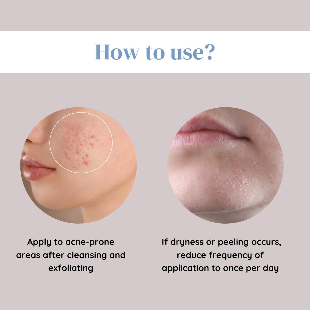 Pack Of 3 Acne Gel