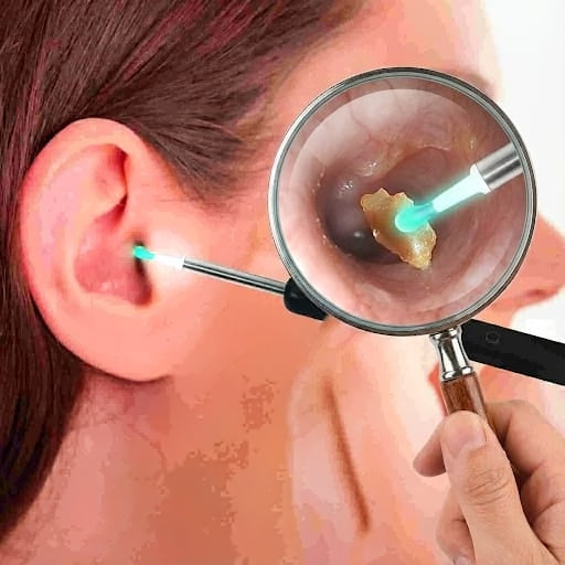 HD Wireless Ear Wax Removal Camera